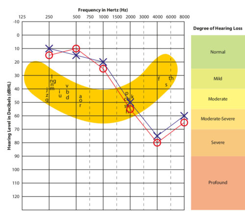 Audiogram with speech banana